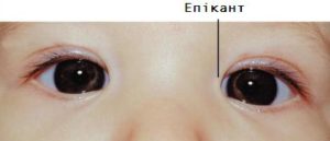 Епікант