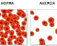 Лікування апластичної анемії операцiя